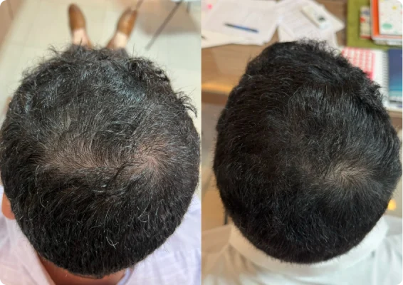 172e72b3_259d_423f_9e23_d3ce942f120d