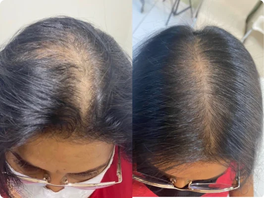 309ac66a_81e6_4f4b_af20_33a052153a27