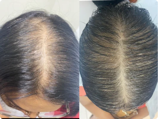 35972ba7_3502_425e_89c7_f2351504ba32